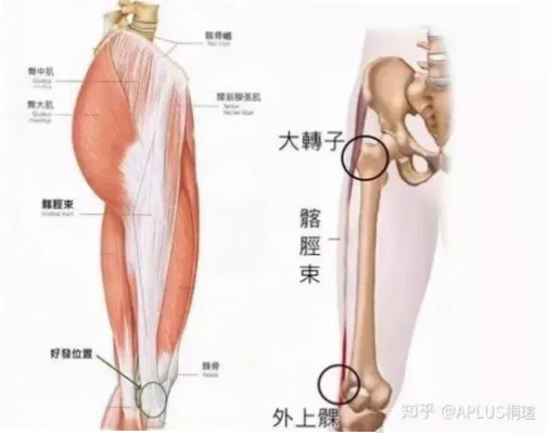 跑步髂胫束康复是许多跑者关注的焦点